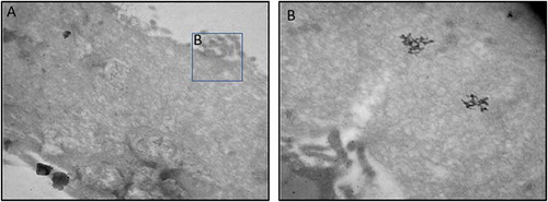 Figure 4. Representative images of MII oocytes labeled with anti-CD9 5nm immuno-gold particles. EVs are present in the oocyte microvilli (black dots) but are not seen in the ZP.