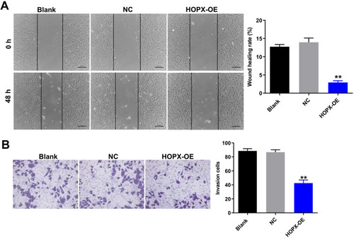Figure 4 Overexpression of HOPX inhibited migration and invasion abilities of breast cancer cells. (A) MDA-MB-468 cells were infected with lenti-HOPX for 48 h. Wound healing assay was used to detect cell migration ability. (B) MDA-MB-468 cells were infected with lenti-HOPX for 24 h. Transwell invasion assay was used to detect cell invasion ability. **P < 0.01, compared with the NC group.