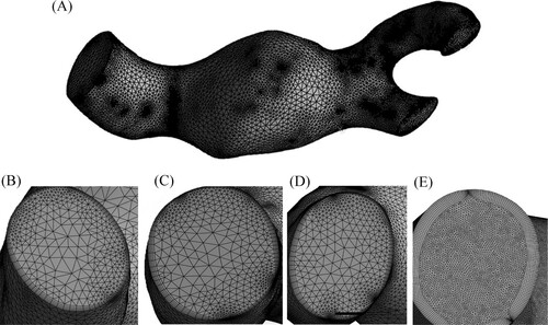 Figure 2. Mesh configuration and convergence analysis. (A) Visualization of AAA within a grid of one million elements. View of AAA inlet in the grid containing (B) 500,000, (C) 750,000, (D) 1,000,000, and (E) 5,000,000 total elements.