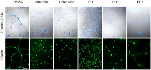 Figure 5. Estradiol dimers inhibit the endothelial cell tube formation angiogenesis. Figure illustrates the network formation of HUVEC primary endothelial cells in the presence of DMSO (control), 60 nM suramine, 60 nM colchicine or 5 × IC50 concentration of ED, ED3 and ED5. The cells and nuclei were visualised using DIC and Hoechst 33342 (blue fluorescence) or calcein (green fluorescence). Scale bar: 200 µm.