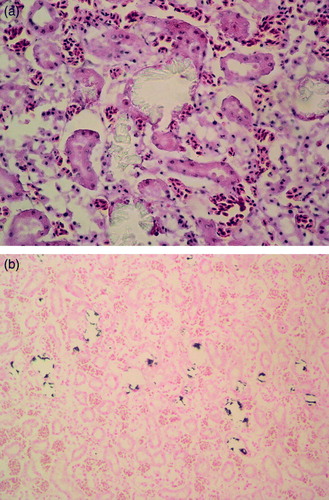 Figure 1.  1a: Pale-yellow calcium oxalate crystals in renal tubular lumens of an EG-intoxicated goose. Severe congestion, and tubular degeneration and necrosis are evident. Haematoxylin and eosin, ×370. 1b: Black-stained calcium oxalate crystals. von Kossa, ×185.