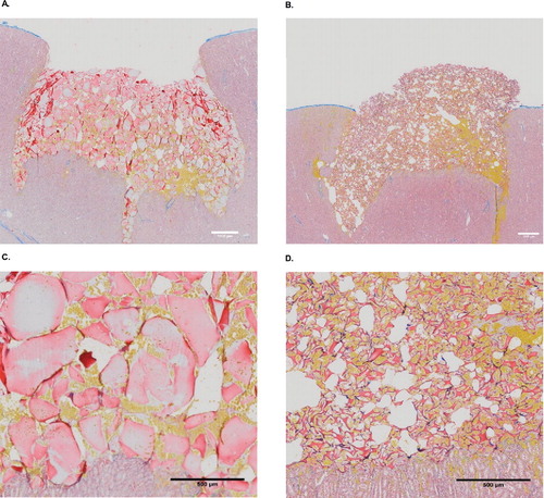 FIGURE 6 Histology of the two hemostatic agents. Images from light microscopy, with Martius-Scarlet-Blue staining. Yellow areas represent fresh fibrin, erythrocytes are stained yellow, and connective tissue is shown in blue. A and C: gelatin–thrombin matrix with smooth particles (SmGM); B and D: gelatin–thrombin matrix with stellate particles (StGM).