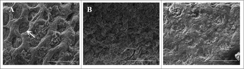 Figure 1. Adherence to Macaca fascicularis intestinal explants. Sections of proximal colon from freshly euthanized cynomolgus monkeys were incubated with strain C227-11 (A), with HS (B) or with media alone for 3 hours (C) and then visualized by Scanning Electron Microscopy (SEM).Citation68 In panel (A), the arrow indicates dilation of the crypts. Scale bar is 100 µm.