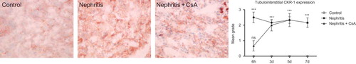 Figure 8.  CXCR1 expression in tubulointerstitium of rat kidneys during the experimental period and histological appearances of kidneys in control (grade 0, at sixth hour), nephritis (grade 3, at sixth hour), and nephritis + CsA (grade 1, at sixth hour) groups. Values are expressed as mean ± SEM. n = 6 at each time point for each group. Notes: ***Denotes p < 0.001 against control group. ns, not significant against control group. CsA, cyclosporine A.