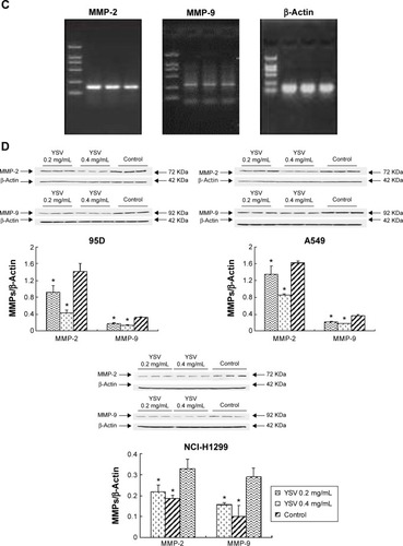 Figure 3 YSV inhibited the expression and activity of MMP-2 and MMP-9.