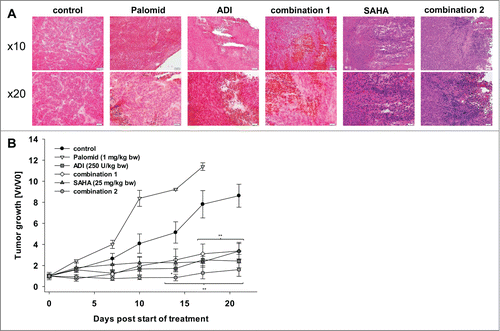Figure 6. HROG05 histology and xenograft growth. Therapy was performed by repetitive local application of ADI (250 U/kg bw), Palomid (1 mg/kg bw), SAHA (25 mg/kg bw) and a combination of either Palomid 529 + ADI (=combination 1) or SAHA + ADI (=combination 2). Each therapy was given twice a week (a total of 6 injections) (n=5 mice per group). Tumor-carrying control animals received equivalent volumes of PBS/DMSO (n = 5 per group). (A) Representative HE staining of HROG05 xenografts. Pictures of 4 μm slides were taken at low and high resolution, respectively. (B) Tumor growth curve. Tumor volumes are given as x-fold increase vs. day 0 (Vt/V0) (start of treatment) ± SD. *P < 0.05 vs. control; **P < 0.01 vs. control.