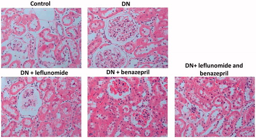 Figure 2. Histological analysis for all groups of rats using HE staining. In DN group, the glomerular basement membrane thickening, segmental differentiation and hypertrophic glomeruli were obviously observed. And in all treatment groups the above pathological changes were apparently alleviated.
