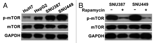 Figure 2. Basal mTOR activity in hepatoma cells. (A) Basal mTOR activity (p-mTOR expression) differs between epithelial and mesenchymal cells. (B) Rapamycin treatment attenuates p-mTOR expression in SNU-387 and SNU-449 cells.