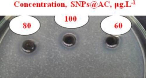 Figure 3. Antagonistic effects of different concentrations of SNPs@AC against Enterococcus fecalis (ATCC 29212).