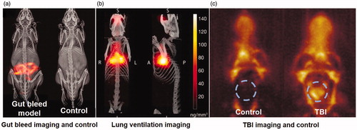 Figure 1. MPI can provide radiation-free, highly sensitive, and high resolution images. (a) Sensitive detection of gastro–intestinal bleed (Reproduced with permission from Yu et al. [Citation43]. Copyright (2017) American Chemical Society.) (b) Evaluation of inhaled drug therapeutics–MPI is not affected by air-tissue susceptibility interfaces and can even image in lungs (Reproduced with permission from Tay et al. Theranostics 2018 [Citation40]). (c) Hemorrhage diagnosis in TBI animal model (Reproduced with permission from Orandoff et al. 2017 Institute of Physics and Engineering in Medicine, IOP Publishing [Citation37]).