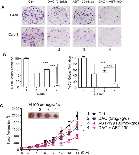 Figure 6. DAC synergizes with Bcl2 inhibitor ABT-199 (venetoclax) against lung cancer in vitro and in vivo. (a) and (b) Human lung cancer H460 and Calu-1 cells were treated with DAC (0.3 μM), ABT-199 (5 μM) or in combination, followed by colony formation assay. Data represent the mean ± SD, n = 3 per group. ***P < .001, by 2-tailed t test. (c) Nu/Nu nude mice carrying H460 xenografts were treated with DAC (3 mg/kg/d) i.p., ABT-199 (30 mg/kg/d) orally, or in combination for 14 days. Tumor volume was measured once every 2 days. After treatment, mice were sacrificed and tumors were removed and analyzed. Data represent the mean ± SD, n = 6 per group. *P < .05, by 2-tailed t test