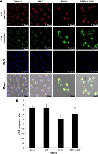 Figure 7 The loss of MMP induced by SiNPs and suppressed by NAC.Notes: HUVECs were treated with 50 μg/mL SiNPs for 24 hours plus NAC pretreatment for 2 hours. The MMP was determined using the fluorescent probe, JC-1. (A) Confocal images of MMP at a magnification of ×1,200. (B) The JC-1 red/green fluorescence intensity ratio was used to express the changes of MMP, and the decreased ratio indicates decrease of MMP. Data are expressed as mean ± SD from three independent experiments. *P<0.05 vs control; #P<0.05 for SiNPs vs SiNPs + NAC.Abbreviations: MMP, mitochondrial membrane potential; SiNPs, silica nanoparticles; NAC, N-acetylcysteine; HUVECs, human umbilical vein endothelial cells; SD, standard deviation; DAPI, 4′,6-diamidino-2-phenylindole.