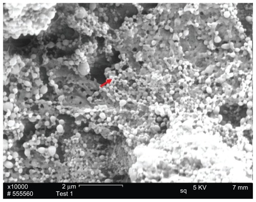 Figure 1 SEM imaging of PLNs.Notes: PLN spheres were deposited on the surface of conductive carbon paper for SEM imaging. The red arrow refers to the PLN.Abbreviations: SEM, scanning electron microscope; PLN, polymer–lipid nanoparticle.