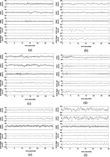 FIGURE 2 Different recorded EEG, EOG, and EMG epochs corresponding to sleep stages: a – W, b – 1, c – 2, d – 3, e – 4, and f – R.