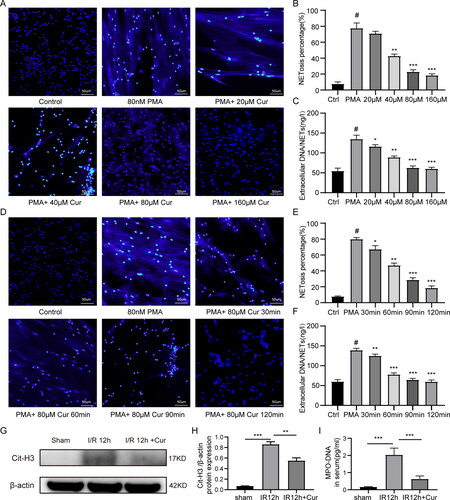 Figure 3. Curcumin inhibits NETs formation in vitro and vivo. (A) Neutrophils obtained from mice were cultured in DMEM medium containing different concentrations of curcumin (20 μM, 40 μM, 80 μM, 160 μM) for 1 h, and then stimulated with 80 nM PMA for 60 min. An upright fluorescent microscope was used to view the NETs’ structural details (magnification, ×200). (B) Quantitative analysis of the percentage of neutrophils NETosis under different conditions. (C) Quantitative analysis of the extracellular DNA/NETs levels. (D) The separated neutrophils from mice were cultured in DMEM medium with curcumin (80 μM) for different time(30 min, 60min, 90min and 120 min), and then stimulated with 80 nM PMA for 60 min. (E) Quantitative evaluation of the percentage of neutrophils experiencing NETosis under various circumstances. (F) Quantitative evaluation of the percentage of neutrophils NETosis under different conditions. (G and H) Detection of Cit-H3 expression by western blot under different conditions. (I) Serum MPO-DNA was measured by ELISA. The statistic diversities amongst groups were evaluated via one-way ANOVA. Data are displayed as the average ± SD. *P < 0.05, **P < 0.01, ***P < 0.001, ****P < 0.0001.