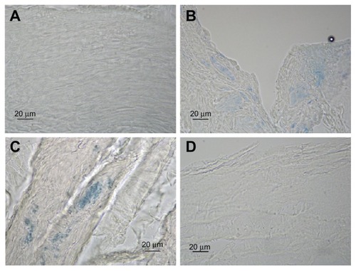 Figure 4 Representative examples of cross-sections of esophageal mucosa after EB perfusion. (A) No stain; undamaged mucosa + EB. (B) Weak stain; damaged mucosa (acid solution 90 minutes) + EB. (C) Strong stain; damaged mucosa (pepsin solution 60 minutes) + EB. (D) No stain; damaged mucosa (acid solution 90 minutes) + Esoxx + EB.