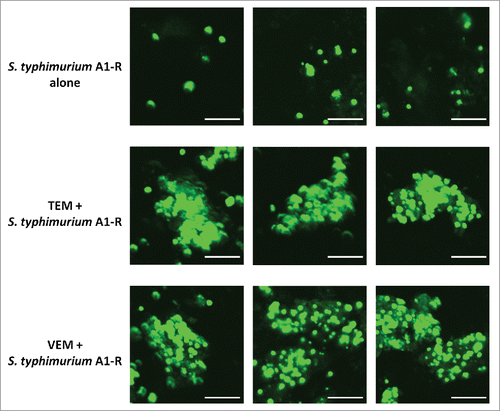 Figure 3. Fluorescence imaging of S. typhimurium A1-R-GFP targeting alone and in combination with chemotherapy in the melanoma PDOX. Confocal imaging with the FV1000. Scale bars: 12.5 μm.