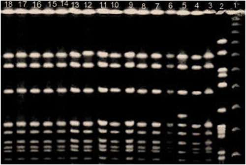 Figure 2. SmaI restriction endonuclease patterns obtained by PFGE: Lane 1, marker; lanes 3,4,7,8,9,10,11,12,13,14,15,16,17,18 MRSA strains showed the same pulsotype; lanes 2, 5, and 6showed three different pulsotypes.