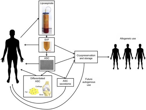 Figure 1 Isolation process and potential therapeutic products derived from lipoaspirate.