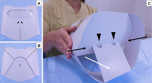 Figure 3 Model 2 of the box-like face shield and its preparation. (A) Front and (B) back oblique views of the face shield before folding. Although the front is similar to Model 1 (A), the lower part of the back is cut off (B-1). Pre-cut incisions, which are usually closed, are positioned near the nasal orifices, to make it possible to collect a nasal swab for viral testing while the patient is wearing the shield (A, black arrows). The sheet is bent along the dotted lines (A, B) upon preparation. (C) Folding process. This model is easily prepared by pushing on both sides toward the center (black and white arrows), which is made possible by gluing the top part of the back to the top part of the front in the center (arrowheads).