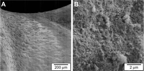 Figure 2 SEM images of the coating microstructure on the screw thread (A) and at a higher magnification (B). The coating topography exhibits a high porosity and high surface.Abbreviations: NB-C, NanoBone® (Artoss GmbH, Rostock-Warnemünde, Germany) coated group; SEM, scanning electron micrographs.