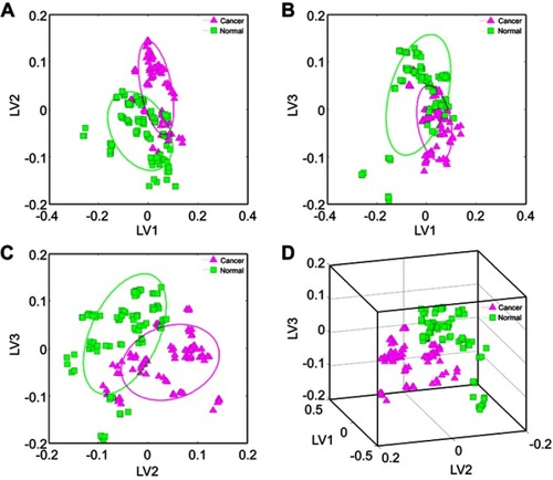 Figure 2 Discrimination of surgical aerosol mass-spectra data analyzed by PLS, demonstrating class separation between aerosol of cancerous tissue and adjacent normal tissue.Notes: (A) 2-D projection plots from PLS analysis of first and second latent variables (LV1 and LV2); (B) 2-D projection plots from PLS analysis of LV1 and LV3; (C) 2 D projection plots from PLS analysis of LV2 and LV3; (D) 3-D projection plots from PLS analysis of the first three latent variables (LV1–LV3) for the surgical aerosolAbbreviation: PLS, partial least squares.