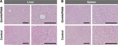 Figure 6 Gross histological analysis of liver (A), spleen (B), kidney (C), brain (D), and peri-implant tissue (E) 120 days after operation (scale bar =200 μm, magnification 100×).Abbreviation: G/nHA/PA66, graphene/nanohydroxyapatite/polyamide66.