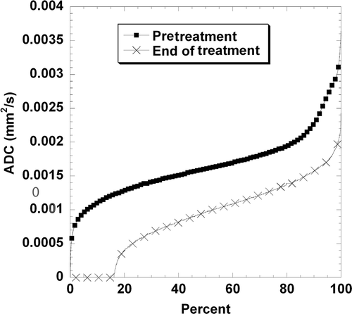 Figure 4. Percentile distribution of apparent diffusion coefficient (ADC) values in an individual tumour before treatment and at the end of treatment. In this subject, treatment led to a generalised decrease in water diffusion but regions where water diffusion was more restricted prior to treatment (low ADC values) were characterised by greater decreases. Every 1000th point is shown. Fewer points are present after treatment because the tumour was smaller. Pre, before treatment.