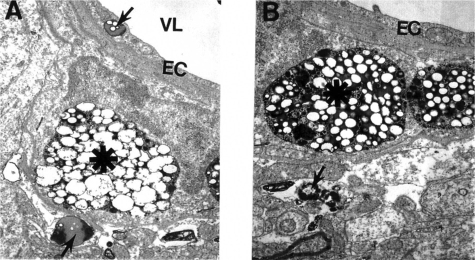 Figure 4 Electron microscopic subcellular features of brain cortical microvessels from 24-month old AβPP-YAC mice. A: Vascular endothelial cells display lipid vacuoles in their cytoplasmic matrices (single arrow). Perivascular cells have “giant”- sized lipid/amyloid granules in their cytoplasmic matrices (indicated by asterisk). Original magnification: ×12,000. B: Microvessels with amyloid “angiopathy” are characterized by the accumulation of large-sized amyloid/lipid granules in the matrices of perivascular cells (indicated by asterisk). Vacuolar structures with lipid filled amyloid deposition (single arrow) are also present in the matrices of perivascular cells. Original magnification: ×12,000.