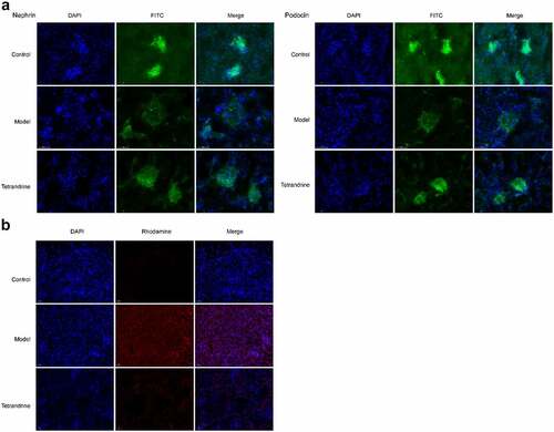 Figure 10. (a) Nephrin and podocin expression of kidney tissues were detected by immunofluorescence staining. (b) The kidney tissues cell apoptosis was analyzed via TUNEL