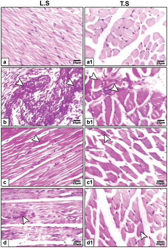 Figure 4. Periodic acid schiff (PAS) staining of tibialis muscle fibers biopsies in 21-day-old rats. a & a1 control showing negative expression. b & b1 neonates of hyperlipidemic mother showing strong expression. c & c1 high fat diet plus germinating barley grains supplementation showing weak expression. d & d1 high fat diet plus germinating fenugreek grains supplementation showing weak expression. Arrow head indicating histochemical reaction of PAS.