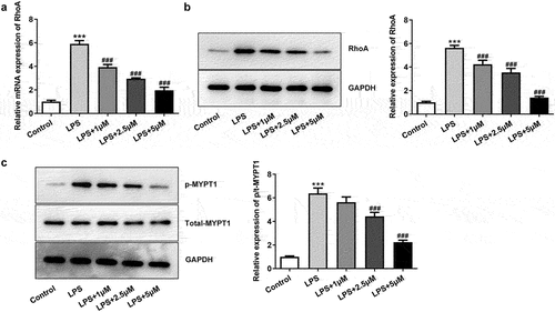 Figure 2. Carvedilol reduces the expression of RhoA and ROCK in LPS-induced BEAS2B cells. (a-b) The expression of RhoA in LPS-induced BEAS2B cells. (c) The expression of MYPT1 in LPS-induced BEAS2B cells. ***P < 0.001 Versus Control, ###P < 0.001 Versus LPS.
