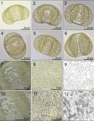 Plate 1. Photographs taken under light microscopy (LM) of Cedrus atlantica pollen grains. Scale indicated on each image. Figures 1–3. Equatorial view showing complete grain. Figures 4–5. Polar view of complete grain. Figures 7–8. Close-up of corpus surface. Figure 9. Corpus surface pattern (extracted using CorelDraw X8). Figures 10–11. Close-up of saccus surface. Figure 12. Saccus surface pattern.