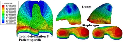 Figure 2. Patient-specific finite element model of the respiratory system.