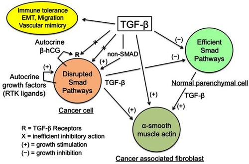 Figure 1 TGF-β regulation of cancer tissue.Notes: Enhanced TGF-β secretion by cancer and stromal cells promotes the development of a dense myofibroblastic microenvironment with CAFs expressing α-smooth muscle actin, together with immune tolerance and EMT, thus plagiarizing the features of the placental trophoblast-decidua interface. Conversely, inhibition of cancer cell growth by the physiological TGF-β cytostatic program is virtually nonexistent, due to various obstacles: impairment of the TGF-β/SMAD axis and of the SMAD-driven gene transcription, high expression of SMAD7, and actions of autocrine growth factors and β-hCG. The β-chain of hCG, a hormone normally produced by trophoblast, may interfere with TGF-β receptors, thus preventing the normal action of TGF-β. The above figure is valid for trophoblastic cells (in place of cancer cells), with the SMAD cytostatic program being silenced by RTK ligands and β-hCG, and for decidual myofibroblasts (in place of CAFs).
