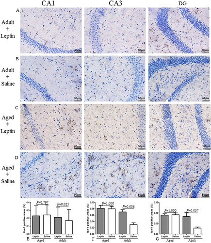 Figure 4 Leptin increased microglial cell number in the hippocampus of adult mice, but not aged mice. (A–D) Representative images of Iba-1+ cells, in the hippocampus sections of the mice. (E–G) Quantitative analysis of Iba-1+ stained cells.