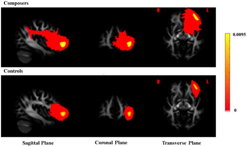 Figure 2. Probabilistic tracings in diffusion tensor imaging of composers and controls, with the FA standard template for HCP in FSL in the background. The color scale of 0.0095 (yellow) is the normalized maximum value for the number of fiber bundles, and voxels with no fiber bundles passing through have a value of zero, giving a transparent color.
