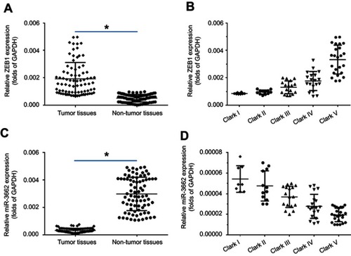 Figure 1 The expression of ZEB1 mRNA in melanoma specimens. A total of 80 paired melanoma and non-tumor clinical specimens were harvested for qPCR experiments. (A) ZEB1 mRNA levels in 80 paired melanoma and non-tumor clinical specimens. (B) ZEB1 mRNA levels in samples at different melanoma stages (Clark I-V). (C) miR-3662 levels in 80 paired melanoma and non-tumor clinical specimens. (D) miR-3662 levels in samples at different melanoma stages (Clark I-V). *P<0.05.