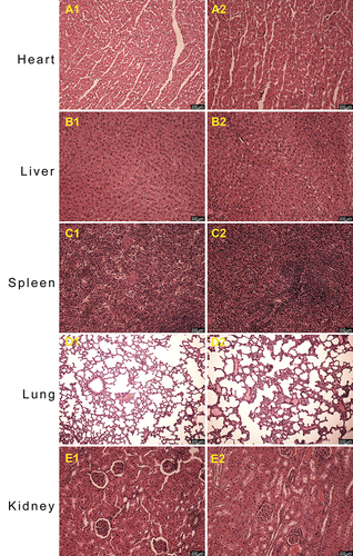 Figure 6 On postoperative day 28, histological analysis of the heart (A1 and 2), liver (B1 and 2), spleen (C1 and 2), lung (D1 and 2), and kidney (E1 and 2) found no abnormalities. The upper row (A1–E1) is the control group (n=10), and the lower row (A2–E2) is the NBD group (n=11, H&E). All samples of animals were examined.