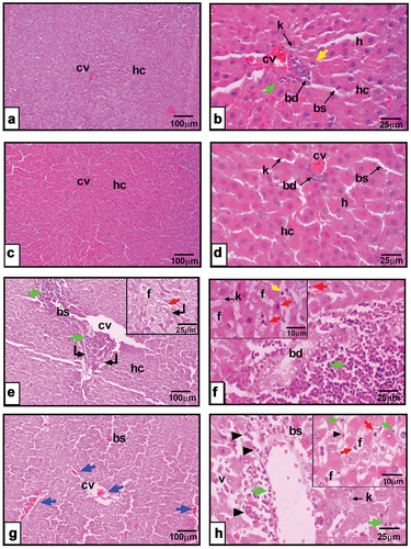 Figure 7. a&b: Photomicrographs of liver section from corn oil fed rats showing hepatic cords (hc), hepatocytes (h), crescent-shaped nucleus (yellow arrow), central vein (cv), monocytes infiltrated (green arrow), blood sinusoids (bs), Kupffer cells (k), bile duct (bd). c&d: liver sections from olive oil fed rats showing hepatic cords (hc), hepatocytes (h), central vein (cv), blood sinusoids (bs), Kupffer cells (k), bile duct (bd). e&f: liver section from rump fat fed rats revealing biliary hyperplasia (bd), macro-vesicular hepatocyte (f), pyknotic nuclei (red arrow), Kupffer cells (k), central vein (cv), blood sinusoids (bs), zonal necrosis (curved arrow), leucocytic infiltration (green arrow), hepatocytes with apoptotic nuclei (red arrow), crescent-shaped nucleus (yellow arrow). g&h: peri-kidney-fat fed rats depicts hepatic cords (hc), dilated central vein (cv), focal hemorrhage here and there in the tissue (blue arrow), inflammatory cells invasion (green arrow), vacuolated hepatocyte (v), pyknotic (red arrow), karyorrhexis (arrowhead). (X100 in right panel, X400 in left panel, X1000 in insets of F&H photomicrographs, H&E).