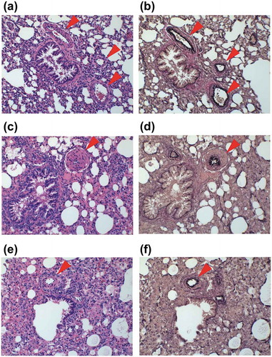 Figure 6. Representative micrographs of the pulmonary arterial wall.(a, b) Control group. (c, d) Groups treated with monocrotaline (MCT) (60 mg/kg) or vehicle. Samples were collected three weeks after MCT administration. (e, f) Group treated with MCT (60 mg/kg) and compound A (10 mg/kg). Compound A was administered for two week from one week after MCT administration. Samples were stained by hematoxylin and eosin (a, c, e) and Elastica van Gieson stain (b, d, f). Arrowheads indicate pulmonary arterial wall.