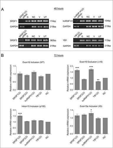 Figure 6. Confirming effect of splicing factors on HER2 mRNA transcripts in SKBR3 cells. A second siRNA sequence was used to reduce the levels of splicing factors (SRSF1, SRSF2, hnRNP H1, and YB1) in SKBR3 cells. Four controls comprising a positive transfection control (GAPDH siRNA (G)), a negative scrambled sequence control siRNA (NC), a vehicle only control (V) and untreated cells (UT) were also used. (A) Reduction of mRNA was determined at 48 hours by classical PCR. (B) HER2 alternative splicing events were measured using splice-specific primers by qPCR at 72 hours post-transfection (mean (n = 3) ± SEM). * P ≤ 0.05, ** P ≤ 0.01, *** P ≤ 0.001.