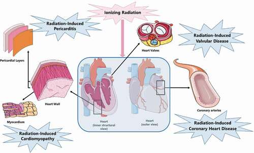Figure 1. Radiation-induced CVD presentation.