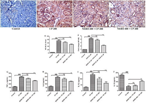 Figure 3. (A-D) Shows the effect of nerolidol 200 and 400 mg/kg, p.o against cyclophosphamide-induced markers of inflammation (NF-κB) in the renal tissue and figure E represents the semi-quantitative analysis of NF-κB level, figures (G-J) represent the effect of nerolidol 200 and 400 mg/kg, p.o against cyclophosphamide-induced markers of inflammation such as TNF-α, IK-6, Il-1β and IL-10, estimated in the in vivo study. (400 × magnification). figure F represents the expression of NF-κB from the in vitro study. One-way ANOVA i.e., tukey’s multiple comparison test was used for statistical analysis.