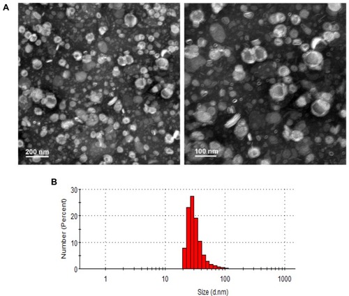 Figure 2 Particle size and morphology of the optimized pRL. (A) Morphology of the pRL observed by TEM. (B) Particle size of the optimized pRL was measured by DLS.Abbreviations: pRL, PEGylation nano-RGP; DLS, dynamic light scattering; TEM, transmission electron microscopy.