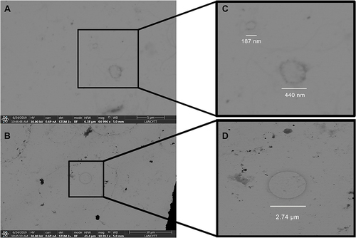 Figure 2 Images of exosomes. Samples were obtained by vaginal self-sampling. The images were obtained by STEM. (A and B) shows vesicles of different sizes corresponding to exosomes. (C) corresponds to magnification of figure (A), where it can be observed two exosomes of different diameters. (D) is the magnification of the exosome found in figure (B), which was six times bigger than the others one. The images were taken by Dr. John Eder Sánchez and Dr. Alejandra Loyola Leyva at the National Laboratory of Science and Technology in Terahertz (LANCYTT) located in the Coordination for Innovation and Application of Science and Technology (CIACYT), San Luis Potosí, S.L.P., Mexico.