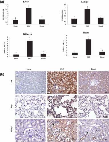 Figure 4. (a) the expressions of HMGB1 mRNA in tissues from rats in each group 24 h after sham/CLP surgeries. Liver, lungs, kidneys and ileum were taken 24 h after surgery. HMGB1 mRNA expression in multiple organs were measured by Real-Time PCR. Etomidate treatment inhibits excessive HMGB1 mRNA expression in various organs. *P<0.05 vs Sham, †P<0.05 vs CLP. (b) Immunohistochemical staining of HMGB1 in liver, lungs, and kidneys from rats 24 h after sham/CLP surgeries (magnification ×400). The expression and translocation of HMGB1 were increased in the septic rats that underwent CLP operation compared with rats that underwent the sham operation (indicated by black arrows), but etomidate treatment attenuated the expression of HMGB1. Sham: sham operation group, CLP: Cecal ligation and puncture with normal saline group, Etomi: Cecal ligation and puncture with etomidate treatment group.