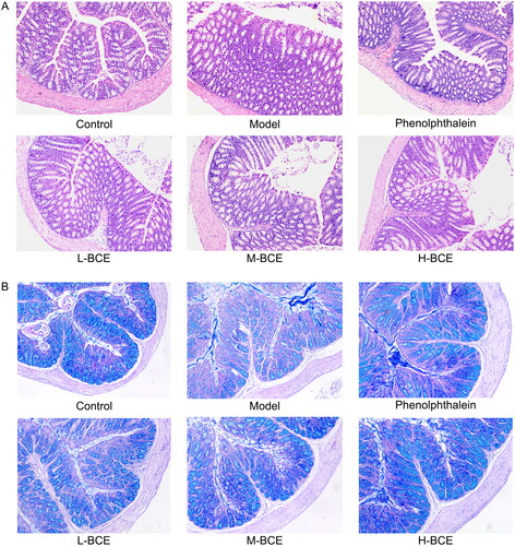Figure 3. BCE attenuated histopathological changes in colon of loperamide-induced constipation mice. (A) Representative H&E staining images of mice, ×100. n = 4 per group. (B) Representative AP/PAS (blue indicates mucin) staining images of mice, ×100. n = 4 per group.