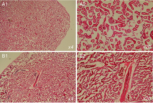 Figure 4. Haematoxylin and eosin staining of tissue sections of kidneys isolated from mice on normal diet (A) and cholesterol diet (B). The mice were 20 weeks of age. The images indicate glomerular and tubular damage.