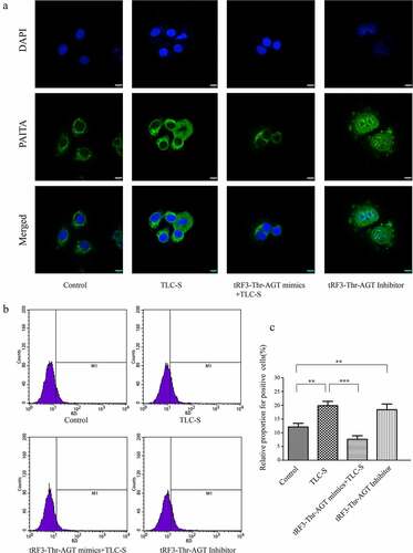 Figure 9. Trypsinogen activation in each group after RNA intervention. a, Image fromlaser confocal microscopy. b, Histogram of flow cytometry. c, Chart of statistics. **P < 0.01. ***P < 0.001.